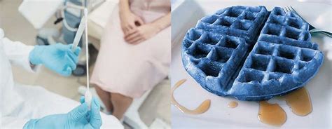 blue waffle nsfw|Blue Waffle Disease Is a Fake STI. Don't Believe the Pictures..